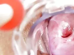 La enfermera en cochina se en el solas bat